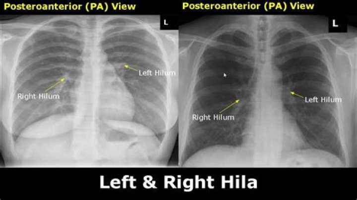 How do I get X ray certified in PA