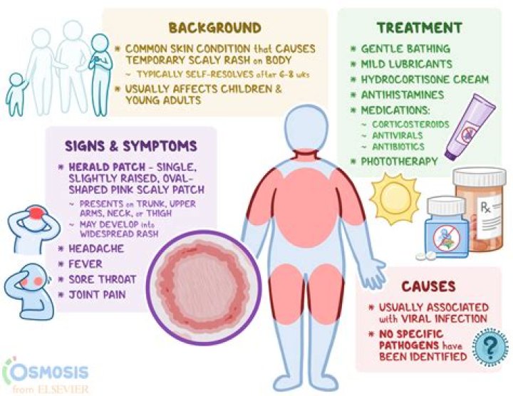 How does a person get pityriasis rosea
