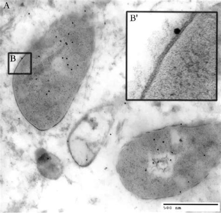 std superbug