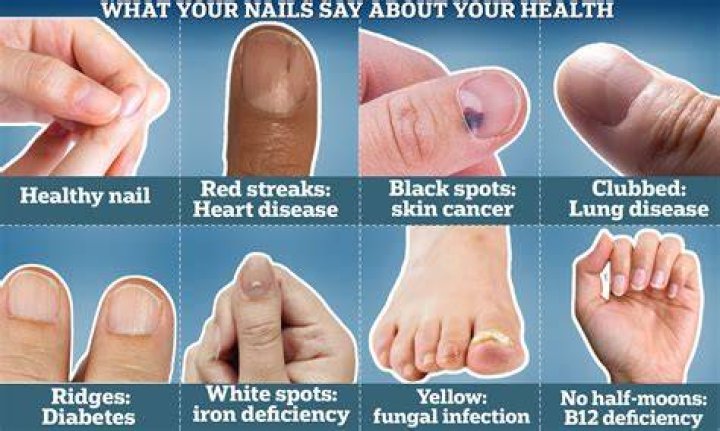 What happens if nails become black