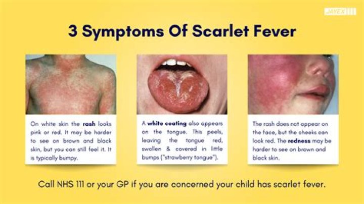 Where does the term fever pitch come from