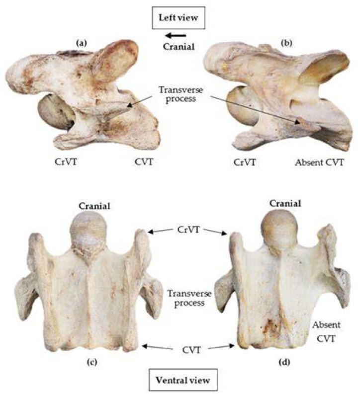 Where does the transverse cervical nerve originate